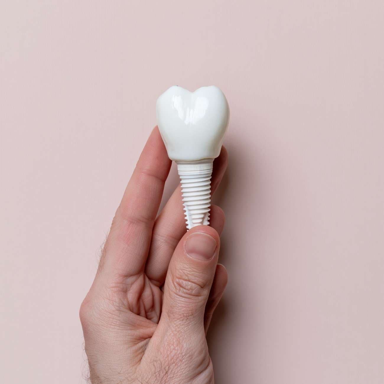 Dental implant tooth replacement options in San Joaquin, California