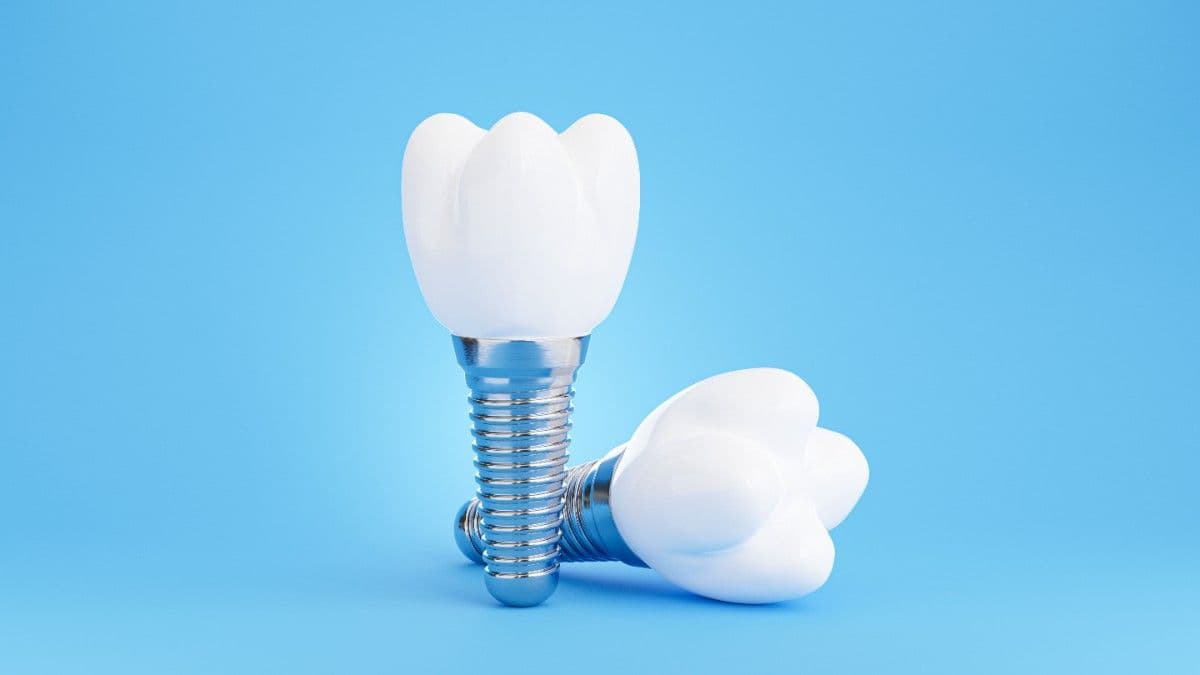 Cost of dental implants in Morada , California